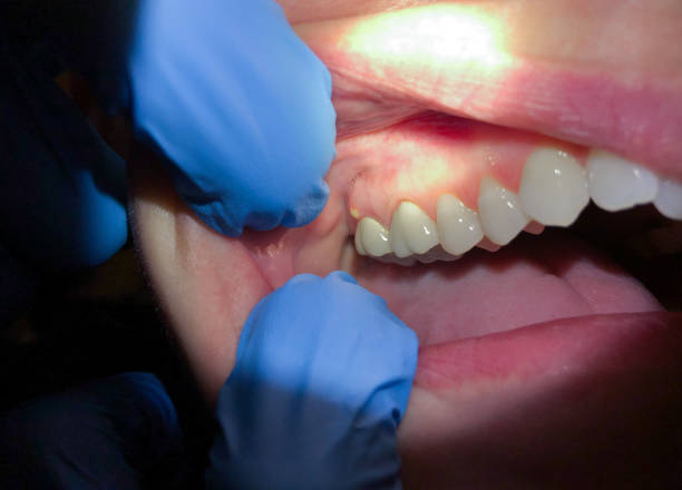 Best Emergency Cosmetic Dentistry in Church Hill, PA